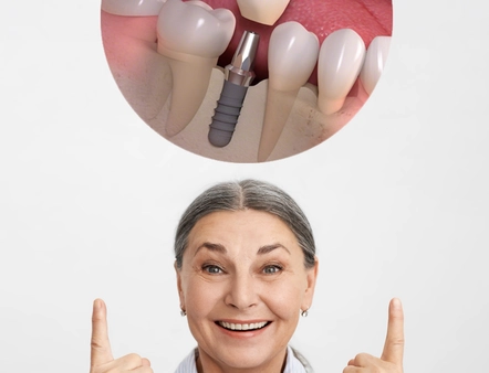 Candidate for dental implants