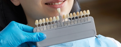 Dental Crowns