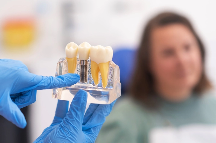 Dental Implants in Simi Valley