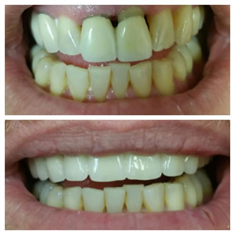 Case 01 Before After Case