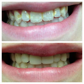 Case 02 Before After Case