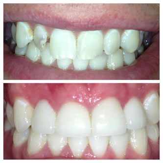 Case 03 Before After Case