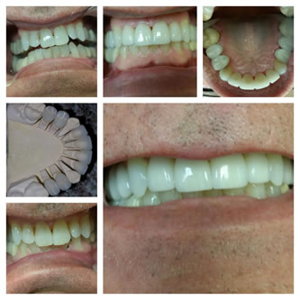 Case 04 Before After Case