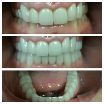 Case 05 Before After Case