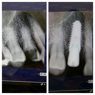 Case 06 Before After Case