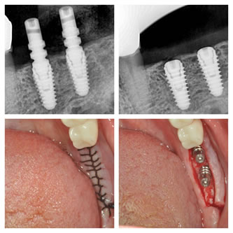 Case 07 Before After Case
