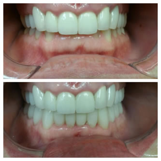 Case 08 Before After Case