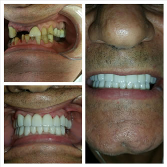 Case 09 Before After Case