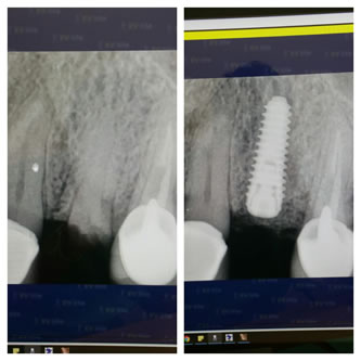 Case 10 Before After Case