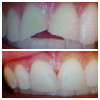 Case 11 Before After Case