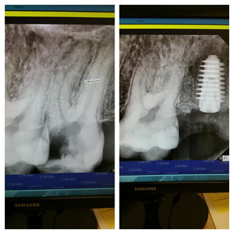 Case 12 Before After Case