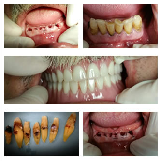 Case 13 Before After Case